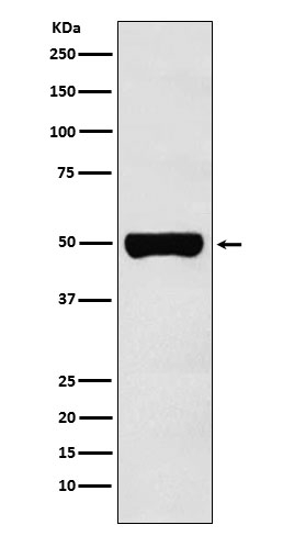 CHX10 Antibody in Western Blot (WB)