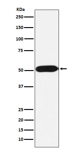 FKBP8 Antibody in Western Blot (WB)