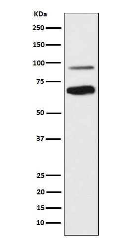 TCF4 Antibody in Western Blot (WB)
