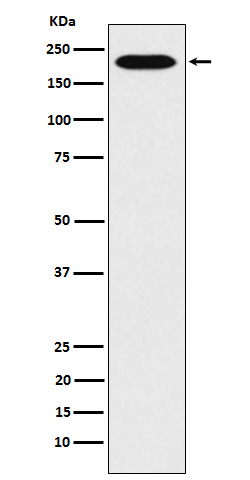 RhoGAP Antibody in Western Blot (WB)