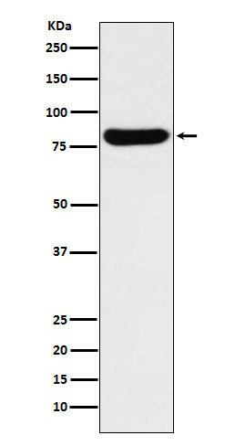 GUSB Antibody in Western Blot (WB)