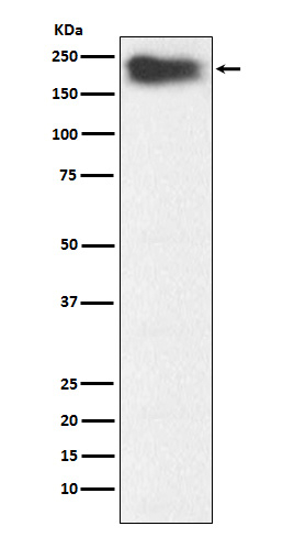 MYH7B Antibody in Western Blot (WB)