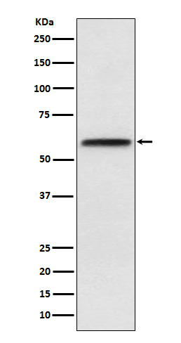LCAT Antibody in Western Blot (WB)