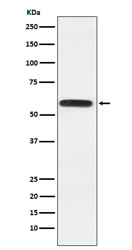LGI1 Antibody in Western Blot (WB)