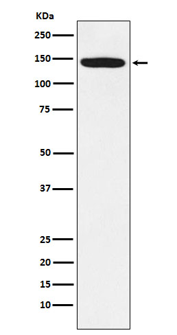 HTATSF1 Antibody in Western Blot (WB)