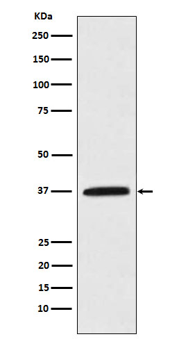 Kallikrein 5 Antibody in Western Blot (WB)