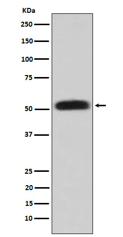 Glycerol kinase Antibody in Western Blot (WB)