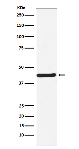 HOXA5 Antibody in Western Blot (WB)