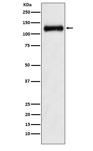 Npr2 Antibody in Western Blot (WB)