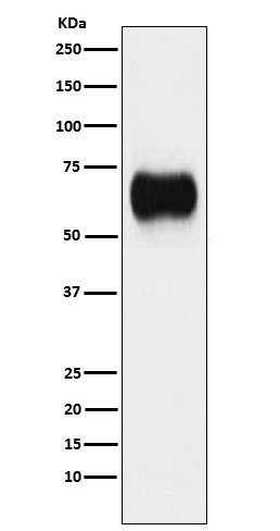 MICA Antibody in Western Blot (WB)