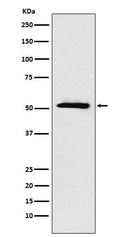 ETV6 Antibody in Western Blot (WB)