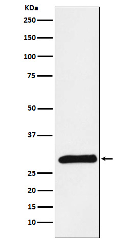 Trypsin 2 Antibody in Western Blot (WB)