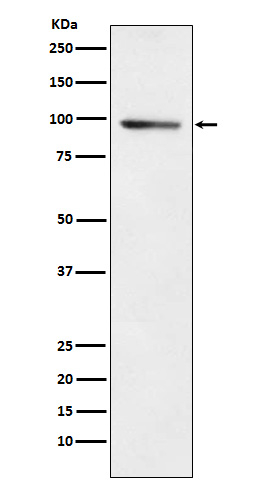 PDE4B Antibody in Western Blot (WB)