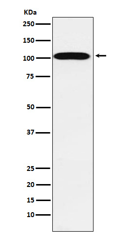 ATP1A2 Antibody in Western Blot (WB)