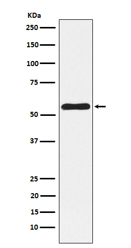 NLK Antibody in Western Blot (WB)