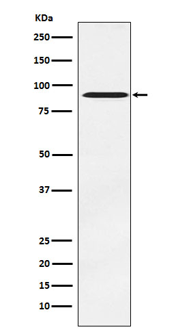 ATRIP Antibody in Western Blot (WB)