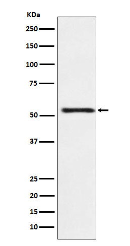 ATP4B Antibody in Western Blot (WB)