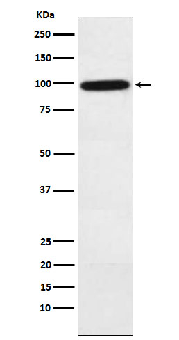 Complement Factor B Antibody in Western Blot (WB)