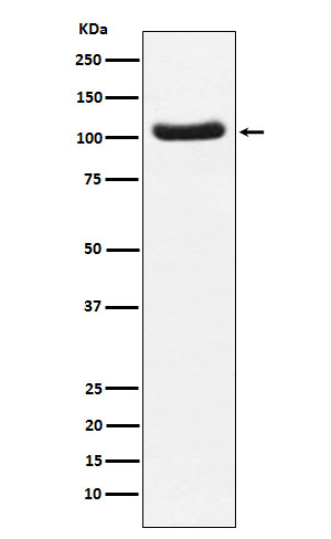 PDE2A Antibody in Western Blot (WB)