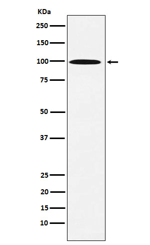 gamma Adaptin Antibody in Western Blot (WB)