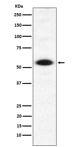 DMAP1 Antibody in Western Blot (WB)