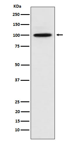 CTNNA3 Antibody in Western Blot (WB)
