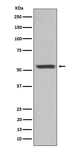 Cytokeratin 12 Antibody in Western Blot (WB)