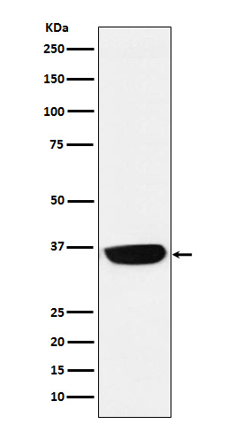 PHOX2B Antibody in Western Blot (WB)
