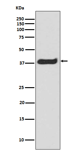 Phospho-LAT (Tyr191) Antibody in Western Blot (WB)