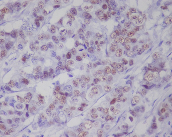 Phospho-p53 (Ser392) Antibody in Immunohistochemistry (Paraffin) (IHC (P))
