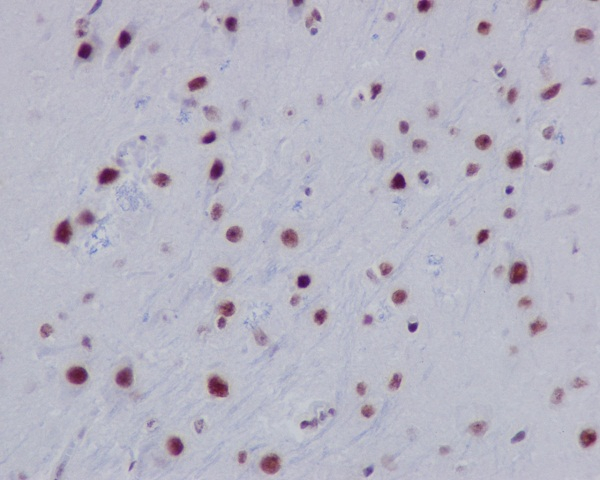 H2AK9ac Antibody in Immunohistochemistry (Paraffin) (IHC (P))