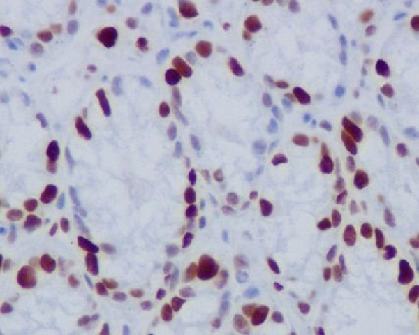 Phospho-Histone H1.4 (Thr17) Antibody in Immunohistochemistry (Paraffin) (IHC (P))