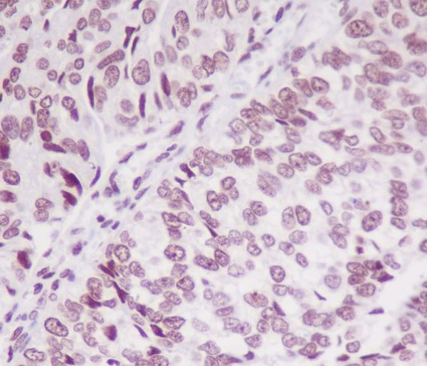 Phospho-SMC1 (Ser957) Antibody in Immunohistochemistry (Paraffin) (IHC (P))