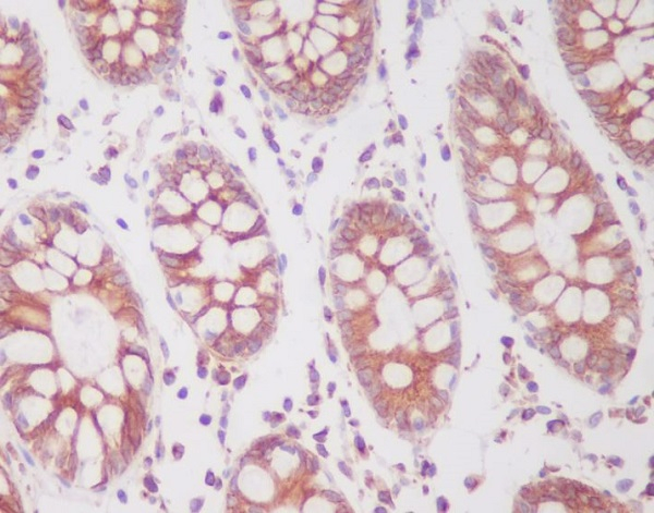 Phospho-SIRT1 (Ser47) Antibody in Immunohistochemistry (Paraffin) (IHC (P))