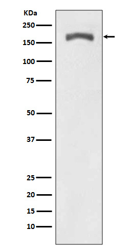 Phospho-PDGF Receptor beta (Tyr740) Antibody in Western Blot (WB)