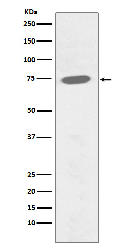 Phospho-Btk (Tyr551) Antibody in Western Blot (WB)