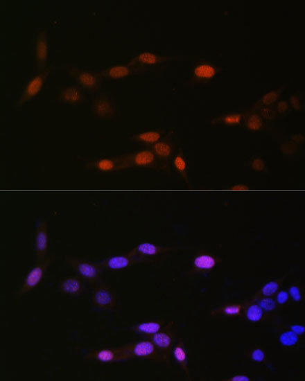 H3K14me1 Antibody in Immunocytochemistry (ICC/IF)