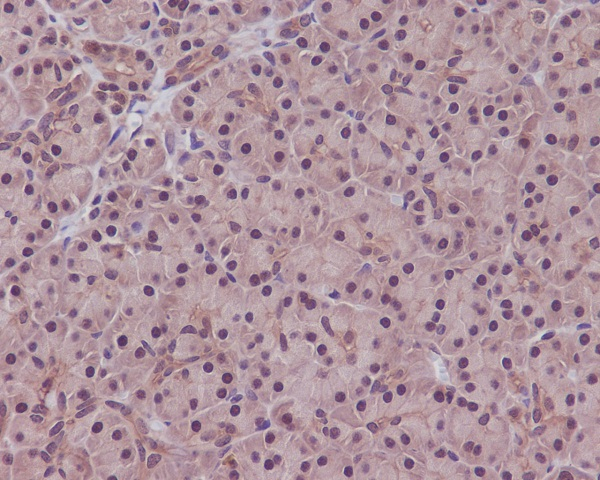PP1 alpha/beta Antibody in Immunohistochemistry (Paraffin) (IHC (P))