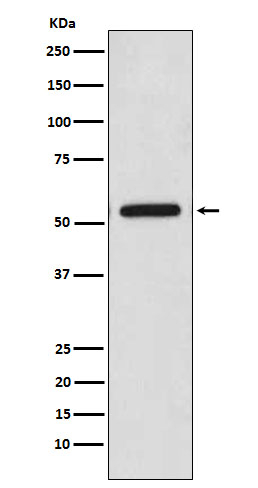 CaMKII Pan Antibody in Western Blot (WB)