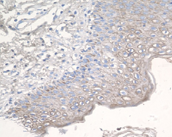 CCR3 Antibody in Immunohistochemistry (Paraffin) (IHC (P))