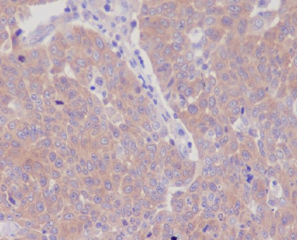 GART Antibody in Immunohistochemistry (Paraffin) (IHC (P))