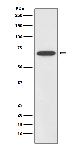 SOX11 Antibody in Western Blot (WB)