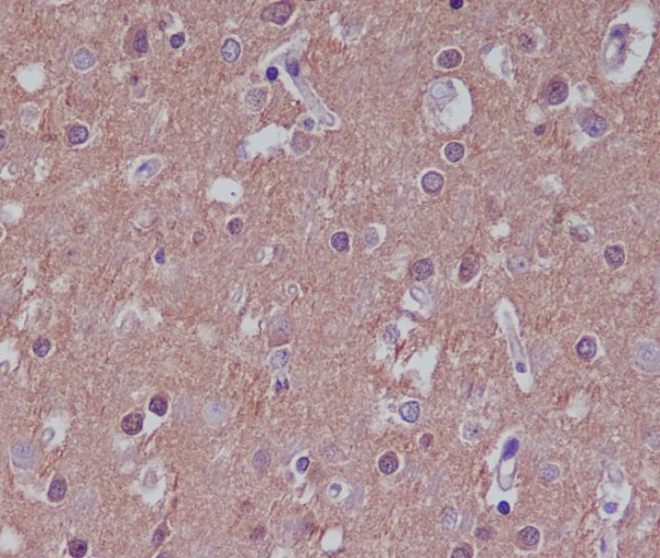 Substance P Antibody in Immunohistochemistry (Paraffin) (IHC (P))