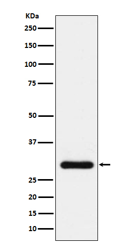 BNP Antibody in Western Blot (WB)