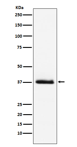 PTH Antibody in Western Blot (WB)