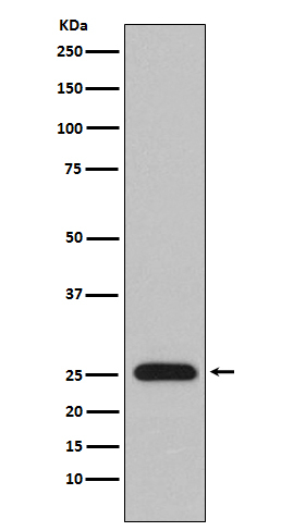 Lambda Light Chain Antibody in Western Blot (WB)