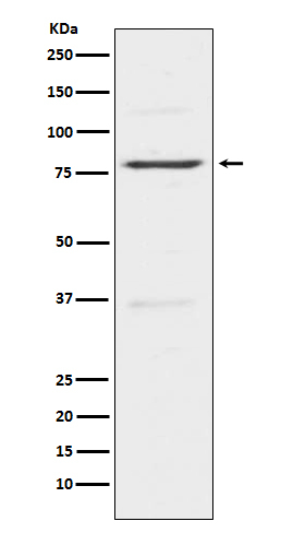 INSRR Antibody in Western Blot (WB)