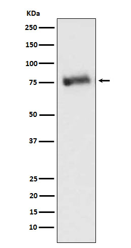 GRK3 Antibody in Western Blot (WB)