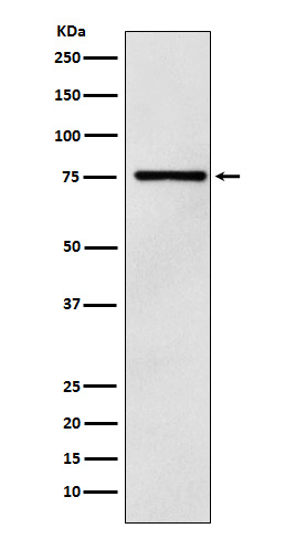 DCP1A Antibody in Western Blot (WB)