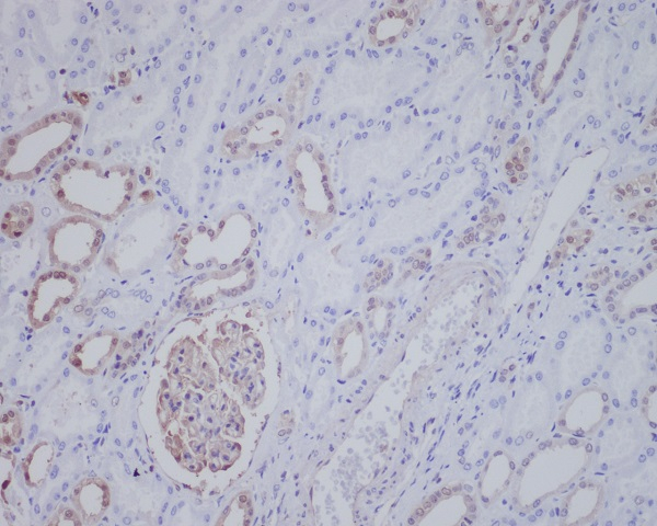 ALK Antibody in Immunohistochemistry (Paraffin) (IHC (P))